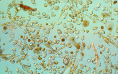 La microalga tóxica Dinophysis acuminata adapta su ciclo vital al sistema de afloramiento de las rías